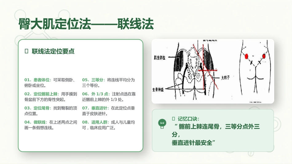 肌内注射定位技术与操作规范_第14页
