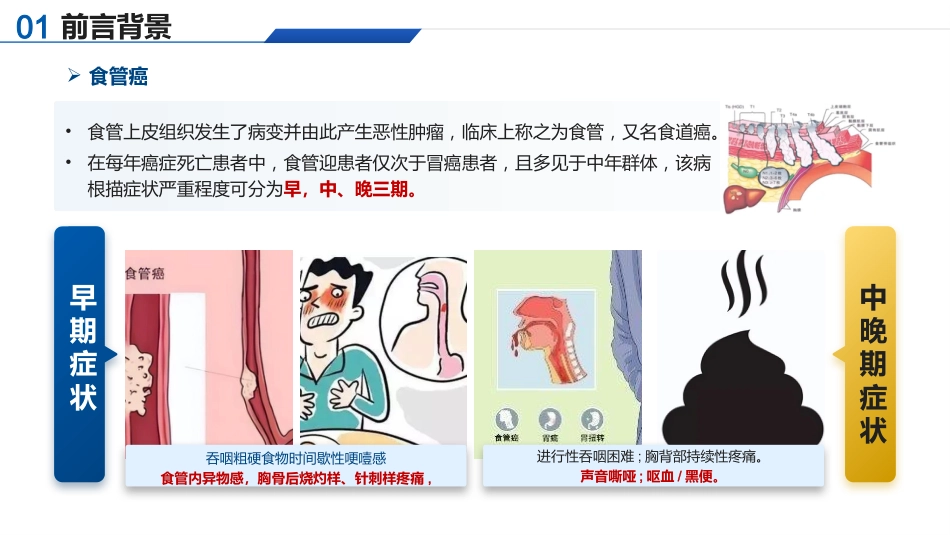 基于高级健康评估的一例食管癌切除术患者的个案护理_第4页