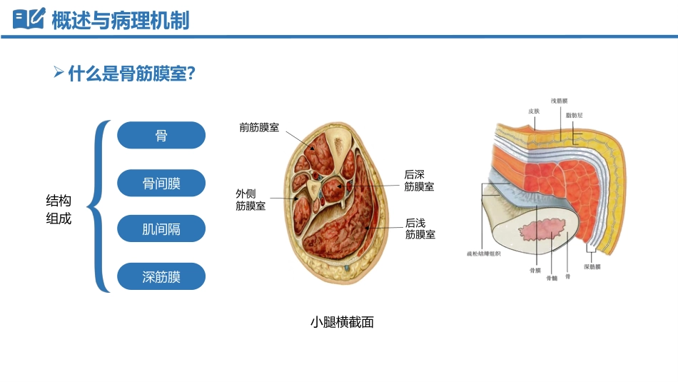 骨筋膜室综合征_第4页