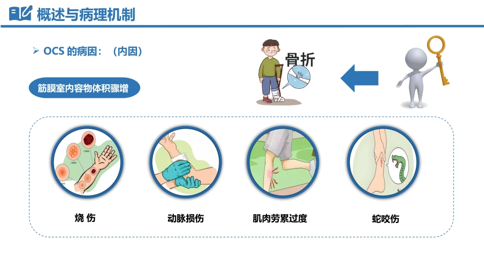 骨筋膜室综合征_第7页