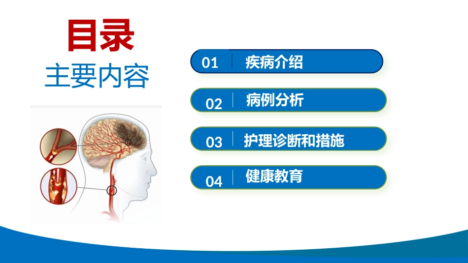 蛛网膜下腔出血患者护理查房_第2页