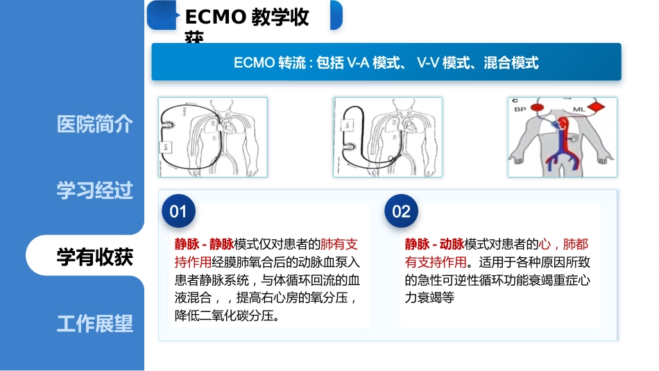 ECMO专科护士进修汇报_第8页