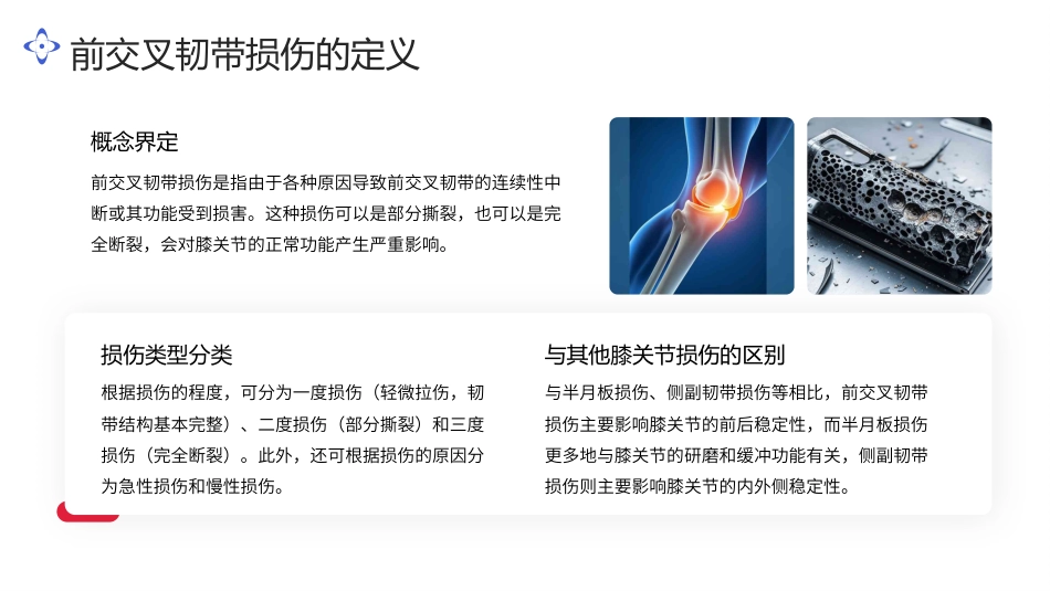 前交叉韧带损伤治疗ppt_第5页