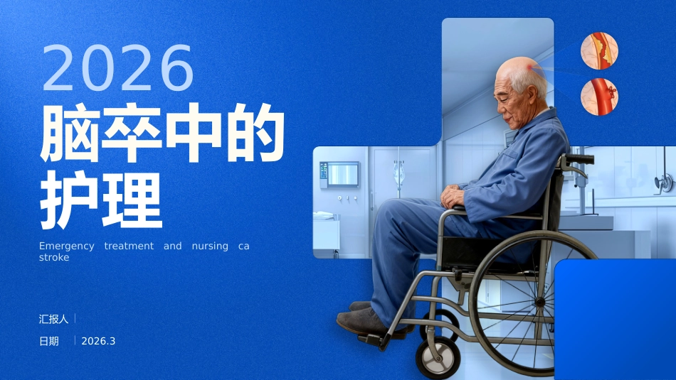 脑卒中的护理_第1页