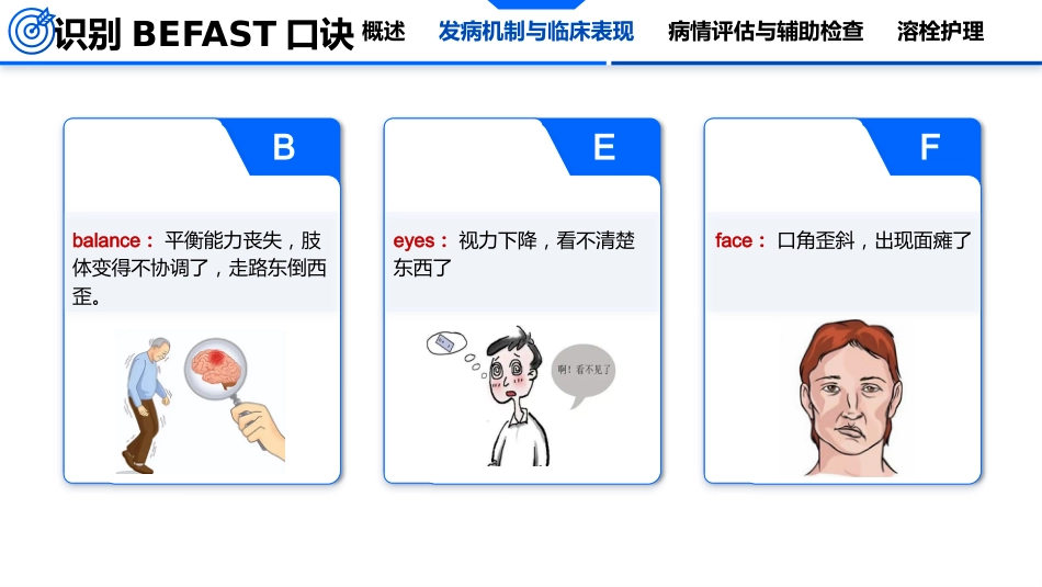 脑卒中的护理_第15页