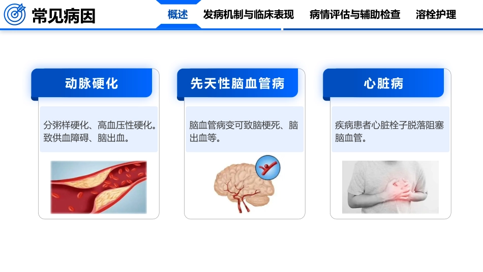 脑卒中的护理_第6页
