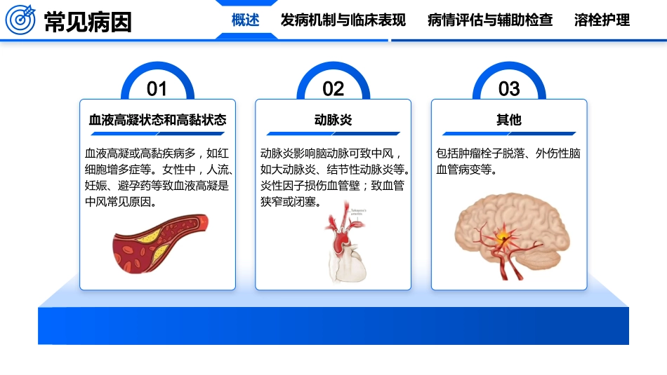 脑卒中的护理_第7页