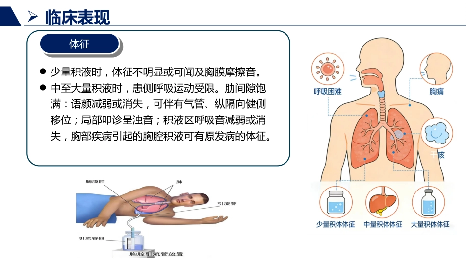 胸腔积液患者护理查房_第11页