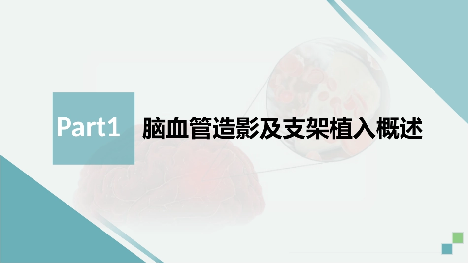 脑血管造影及支架植入术后护理_第3页