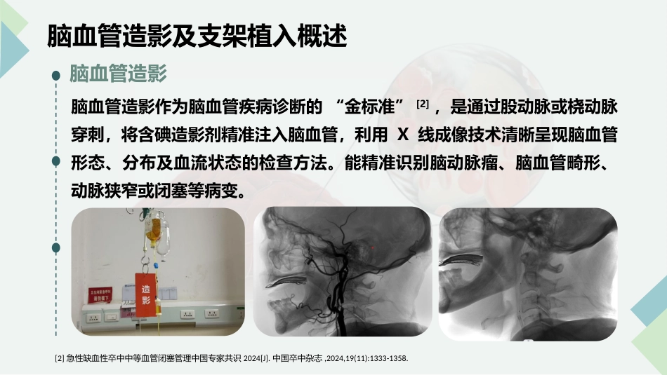 脑血管造影及支架植入术后护理_第5页
