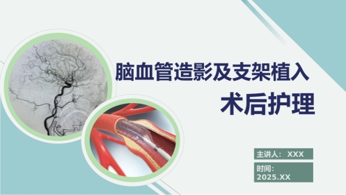 脑血管造影及支架植入术后护理