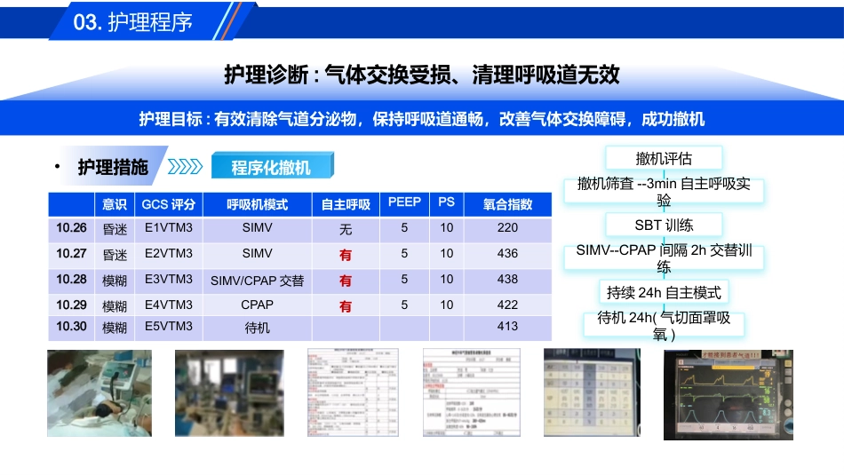 一例气管插管拔管失败患者的肺康复护理_第13页