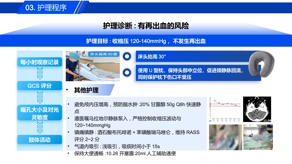 一例气管插管拔管失败患者的肺康复护理_第9页