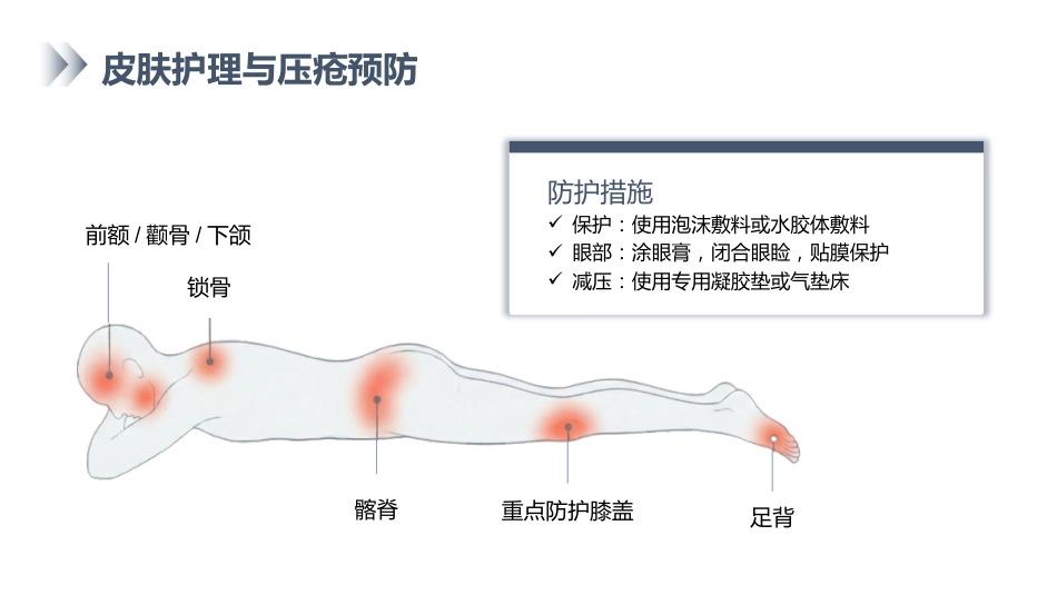 俯卧位通气的护理_第12页