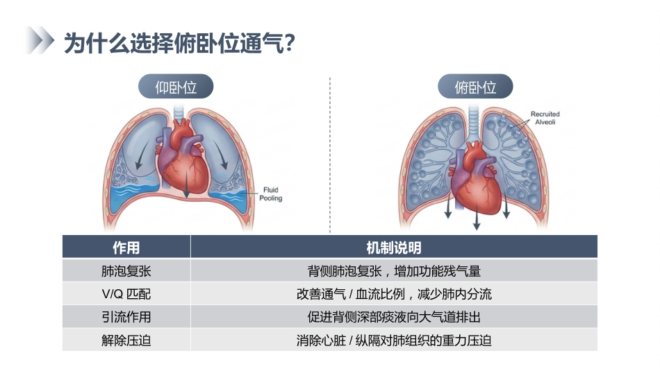 俯卧位通气的护理_第3页