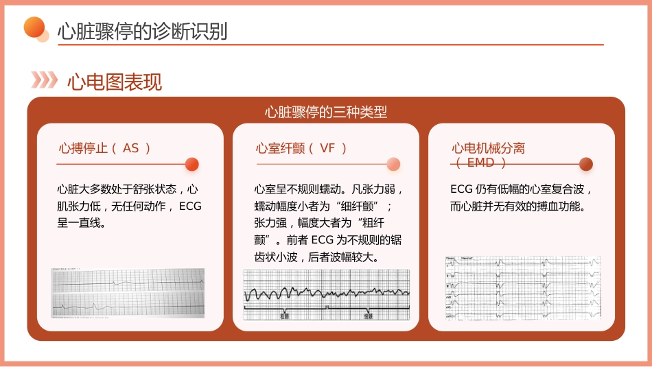 心脏骤停的急救与护理_第9页