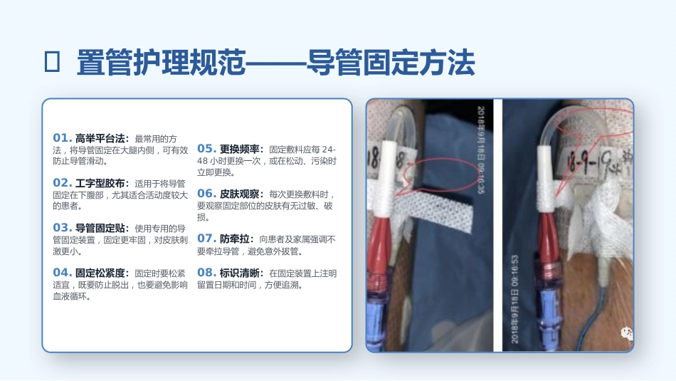 留置尿管护理与尿路感染预防规范_第12页