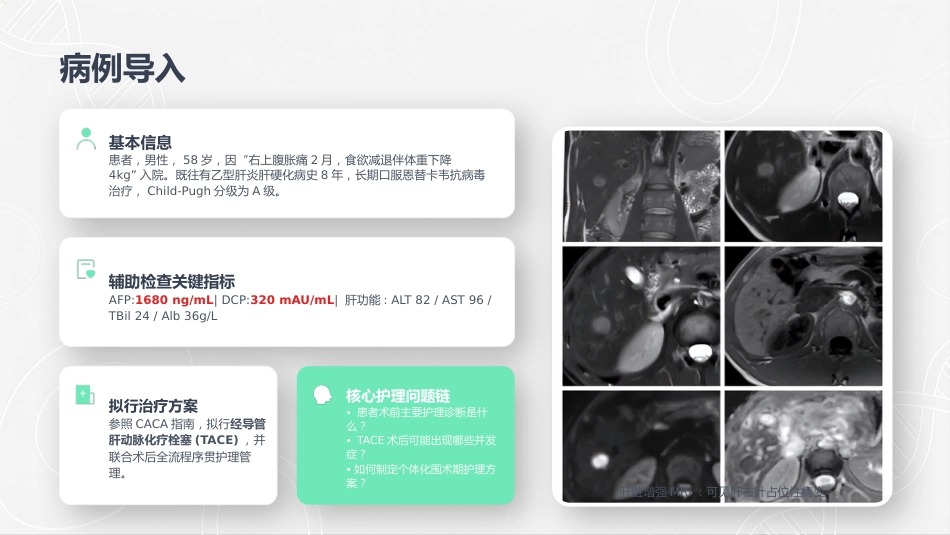 肝细胞癌介入治疗的护理查房_第4页
