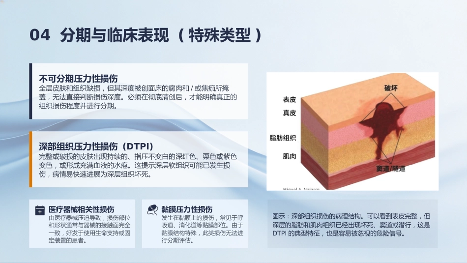 压力性损伤的预防及护理_第14页
