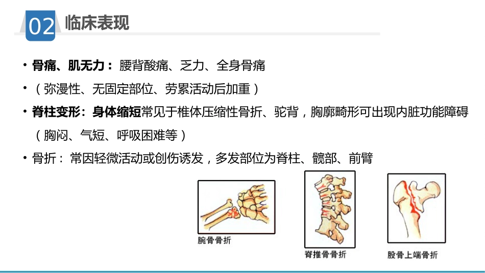 骨质疏松护理业务学习_第12页
