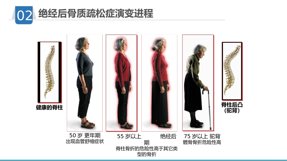骨质疏松护理业务学习_第13页