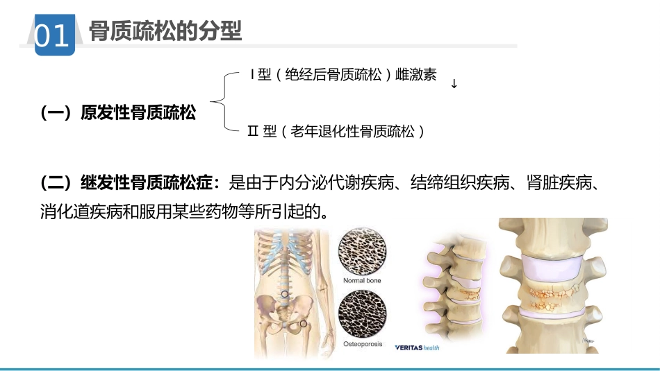 骨质疏松护理业务学习_第6页
