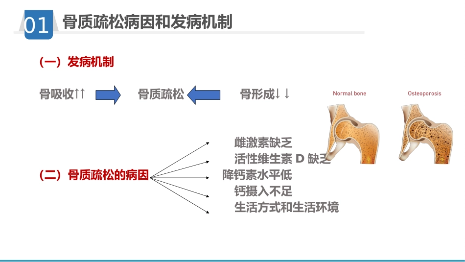 骨质疏松护理业务学习_第8页