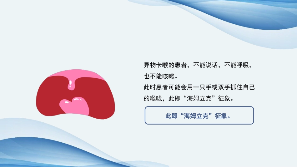 海姆立克急救法ppt课件(完美版)精选全文_第12页