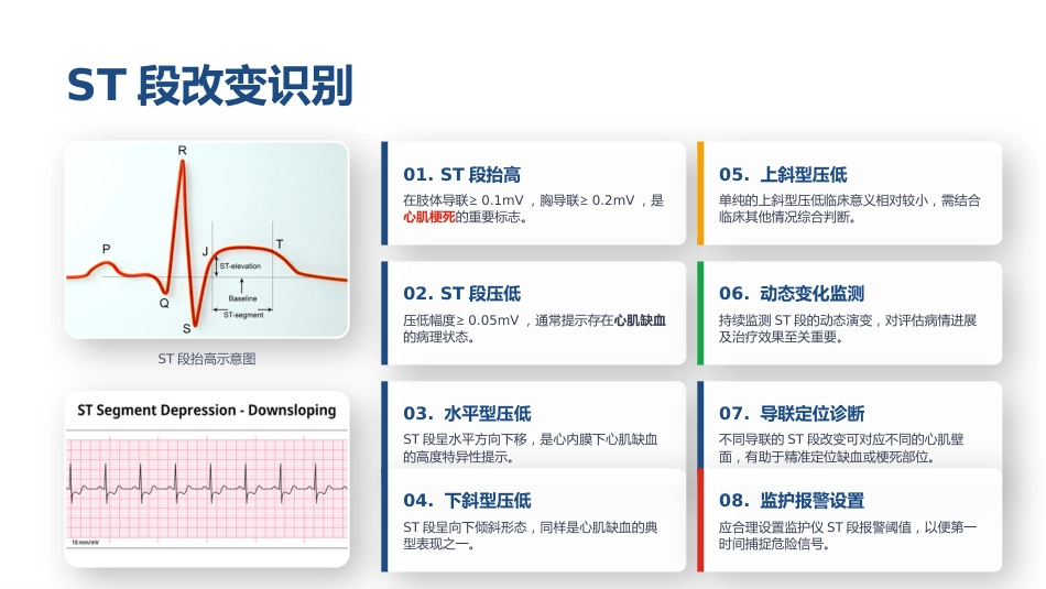 心电监护仪临床应用与参数解读_第11页