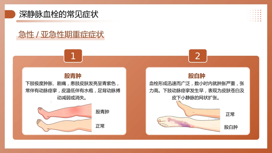 深静脉血栓预防管理讲座_第10页