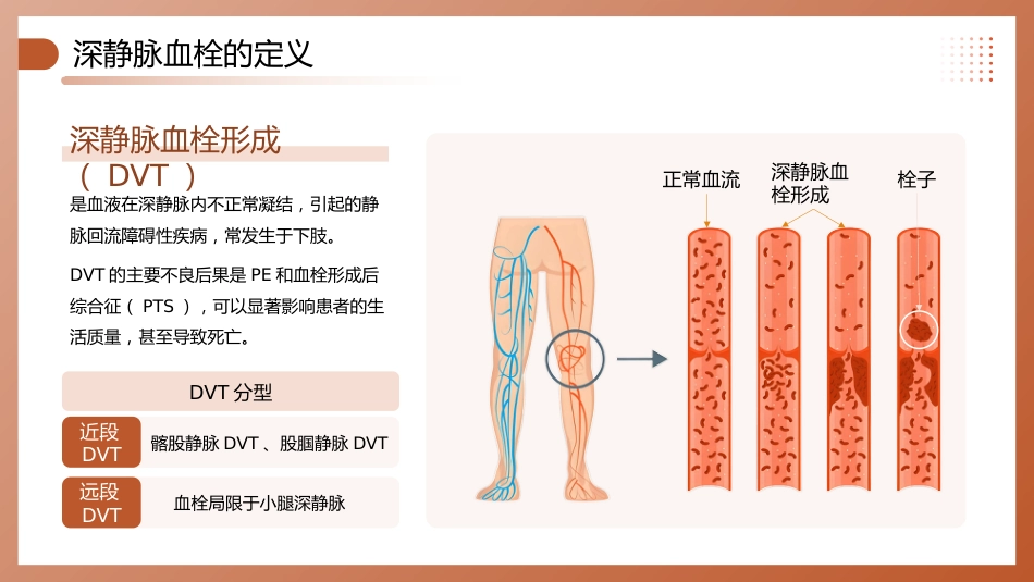 深静脉血栓预防管理讲座_第5页