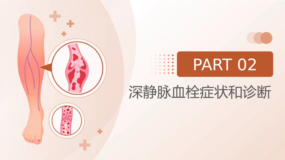 深静脉血栓预防管理讲座_第8页