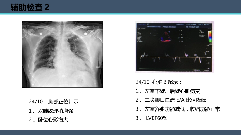 一例PCI术后老年患者心脏康复的个案护理_第14页