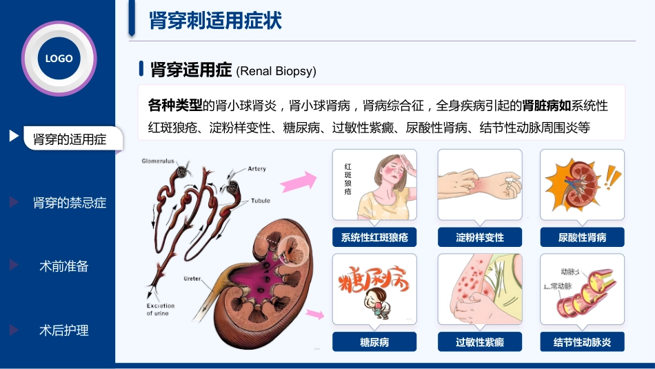 肾穿刺患者的护理_第5页