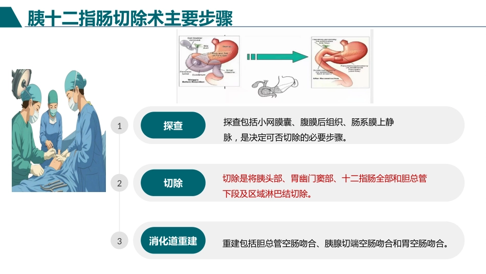 胰十二指肠切除术护理查房_第13页