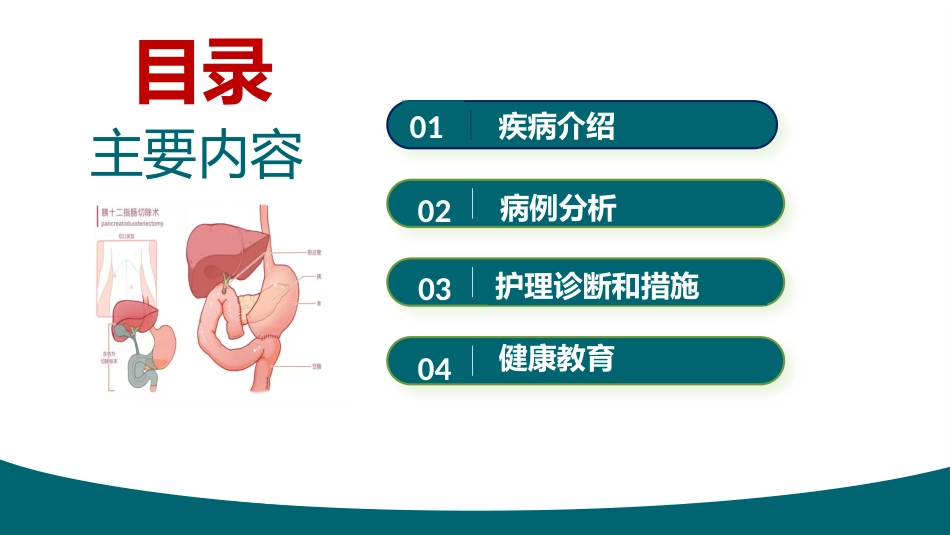 胰十二指肠切除术护理查房_第2页