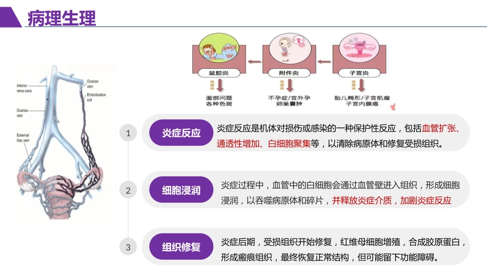 一例盆腔炎患者护理查房_第6页