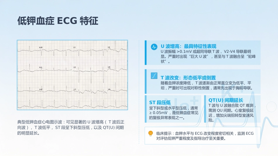 电解质紊乱的ECG表现_第11页