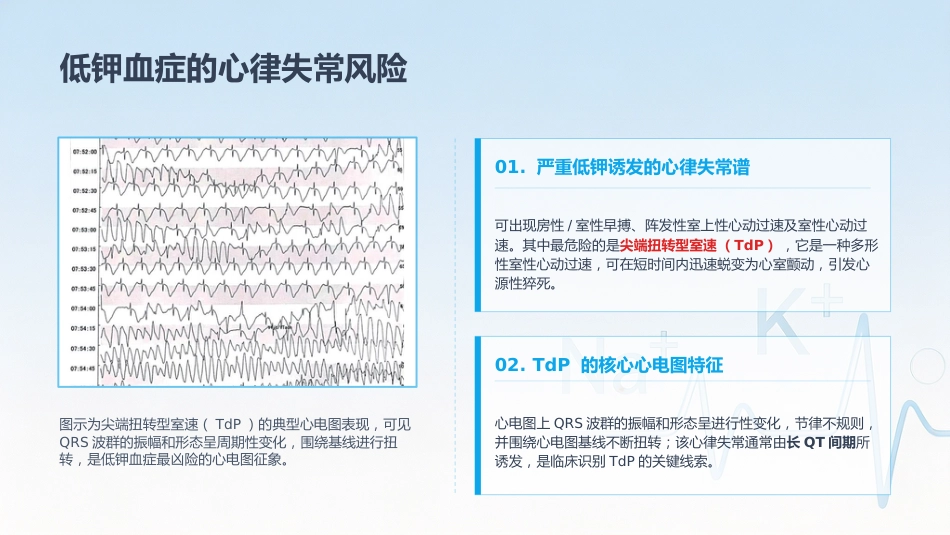 电解质紊乱的ECG表现_第12页