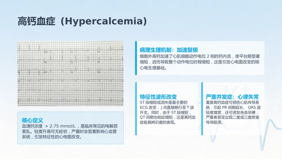 电解质紊乱的ECG表现_第15页