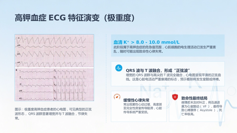 电解质紊乱的ECG表现_第8页