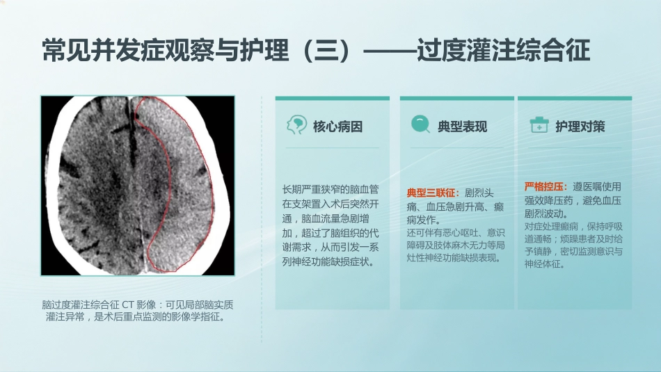 脑血管介入术后护理教学查房_第13页