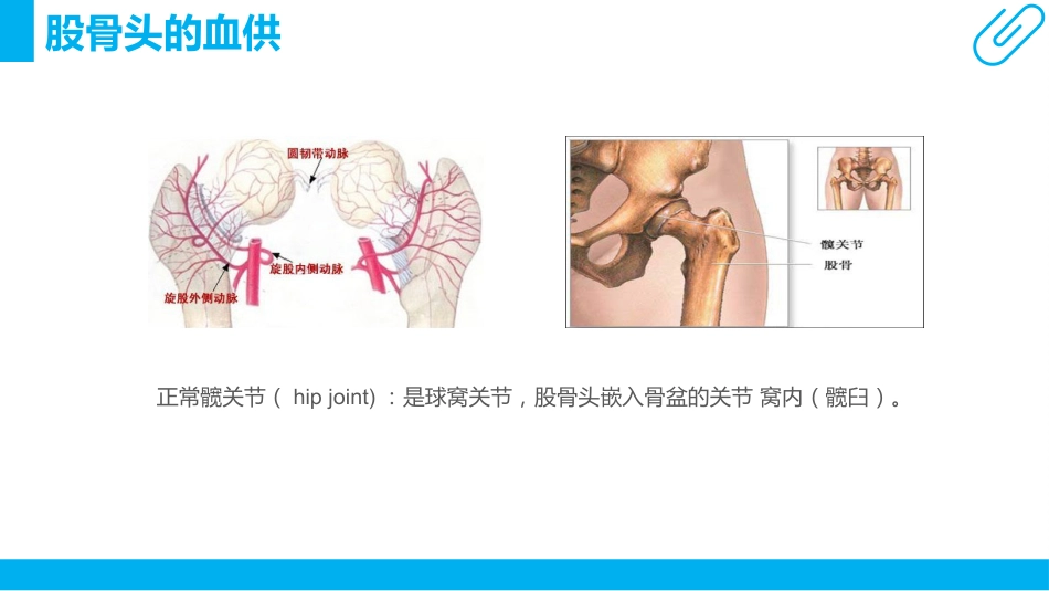 骨科护理查房ppt_第9页