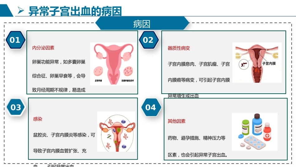 一例异常子宫出血患者护理查房_第9页