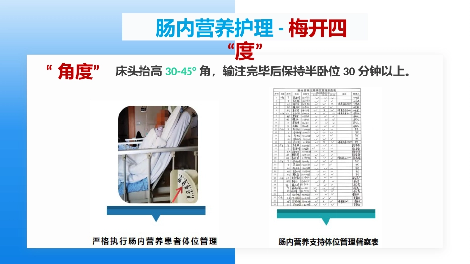 肠内营养支持患者的护理_第14页