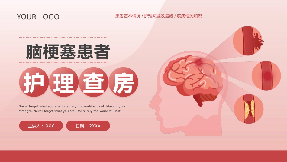 脑梗塞护理查房_第1页