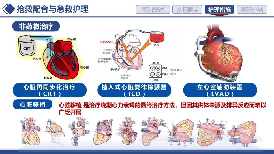急性心力衰竭的护理讲课_第12页