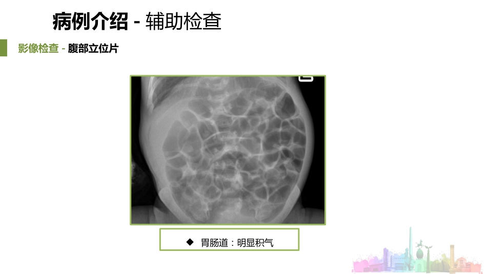 一例新生儿呼吸窘迫综合征患者的护理_第12页