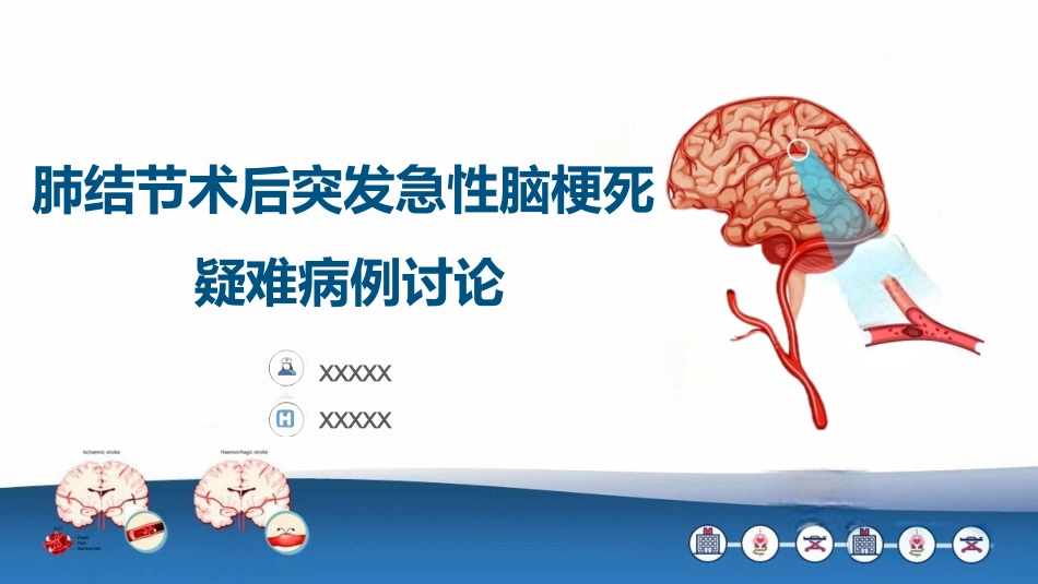 一例肺结节术后突发急性脑梗死疑难病例讨论_第1页