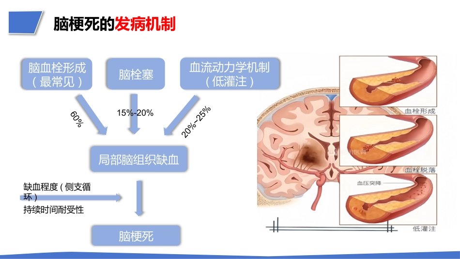 一例肺结节术后突发急性脑梗死疑难病例讨论_第13页